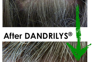 With GREENTECH, Wake up your hair and your mood!