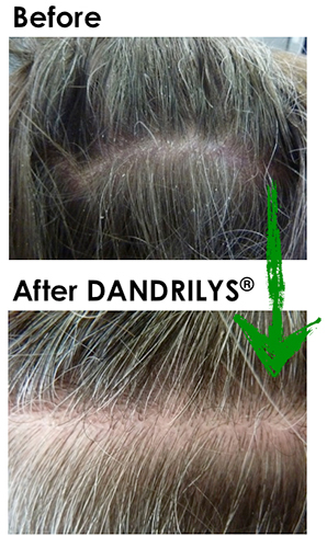 With GREENTECH, Wake up your hair and your mood!